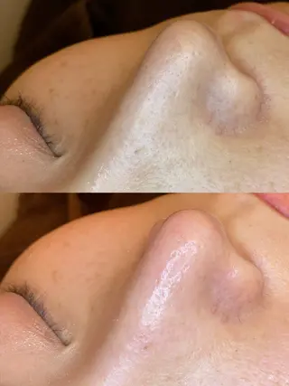 EARTH coiffure beaute 新潟紫竹山店所属・🤍アベシュリ /フェイシャル🤍のエステ・リラクイメージ