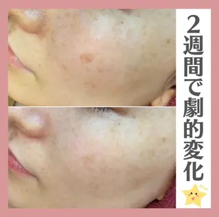 伊藤 稚菜のエステ・リラクイメージ