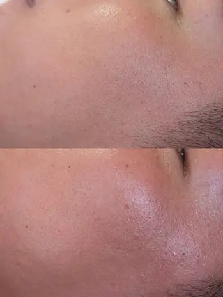 Morphome所属・【Morphome】 hinaのエステ・リラクイメージ