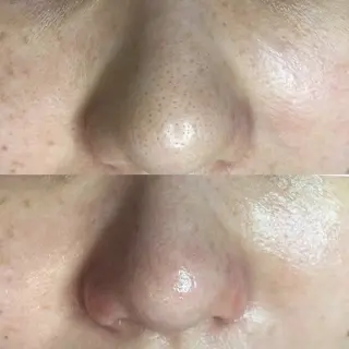 毛穴・シミ専門店MeMe多治見店所属・MeMe 多治見のエステ・リラクイメージ