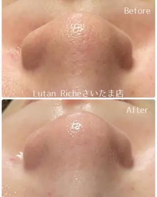 Lutan Richeさいたま店所属・ルタンリッシュ さいたま店のエステ・リラクイメージ