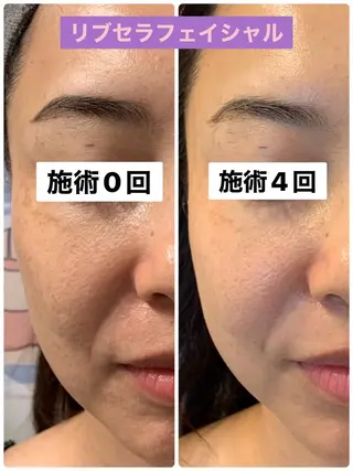 Private Salon Prunelle所属・プライベートサロン プリュネルのエステ・リラクイメージ