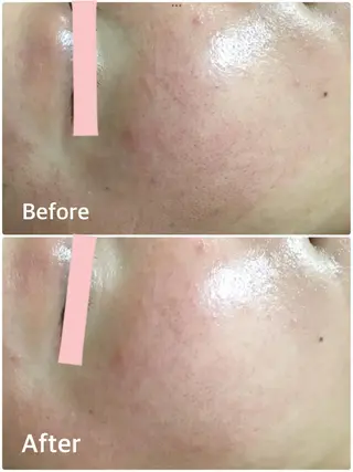 レイビス盛岡店 ♡吉田♡のエステ・リラクイメージ