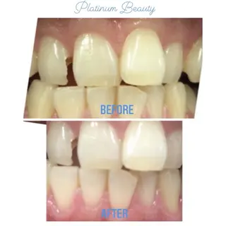 プラティーヌ ボーテのその他イメージ