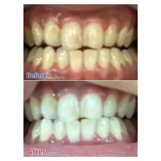 M渋谷店所属・Ｍ渋谷 ホワイトニングのエステ・リラクイメージ