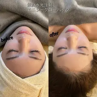 REMENTE池袋東口店所属・REMENTE🪞 KANAのエステ・リラクイメージ