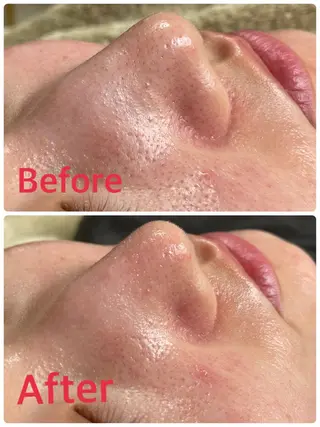 カラー パーマ ヘアアレンジ メンズ キッズ 毛穴，ニキビ跡 改善総合サロンのエステ・リラクイメージ