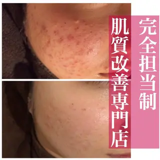 ミディアム カラー パーマ ヘアアレンジ メンズ キッズ ネイル マツエク・マツパ アイブロウ ニキビ・肌質改善専門 ♡人生が変わるサロンのエステ・リラクイメージ