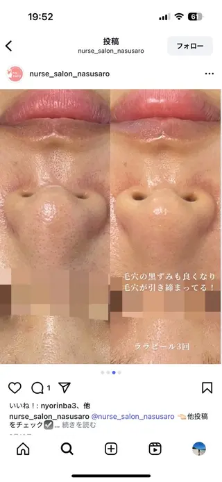 看護師が施術する美容 ナスサロ/川口のエステ・リラクイメージ