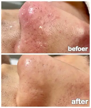 エステルーム　ラティア所属・今井 登美子のエステ・リラクイメージ