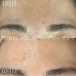 中目黒ハーブピーリン グ🌿ララピールのエステ・リラクイメージ