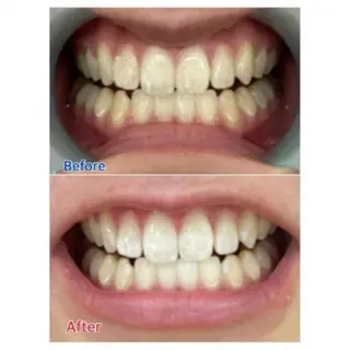 M渋谷店所属・Ｍ渋谷 ホワイトニングのエステ・リラクイメージ