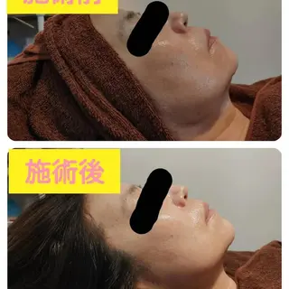 viage所属・viage 脱毛&フェイシャル店のエステ・リラクイメージ