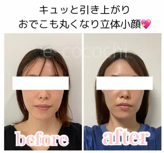 小顔と ヘッドスパのお店のエステ・リラクイメージ