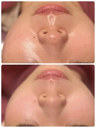 Lien オーナー　山口智嘉のエステ・リラクイメージ