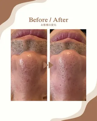 NOAR Risaのエステ・リラクイメージ