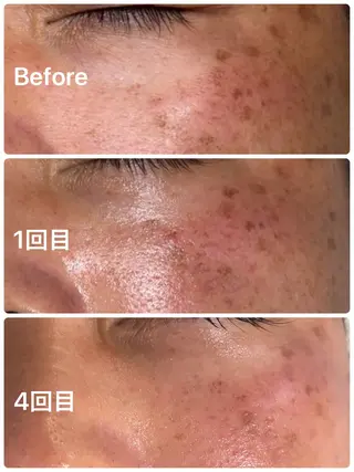 facial salon D 吉沢のエステ・リラクイメージ