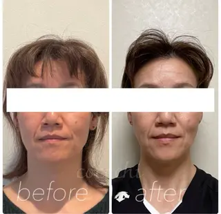 小顔と ヘッドスパのお店のエステ・リラクイメージ