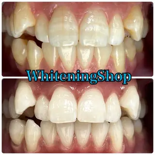 ホワイトニング ショップ吉祥寺店のエステ・リラクイメージ