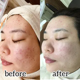 laluna saki...のその他イメージ