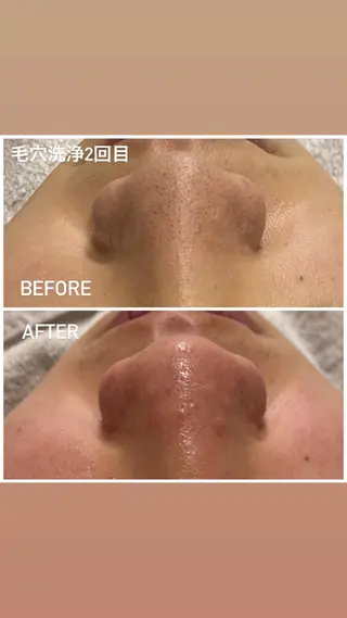 毛穴洗浄・痩身・脱毛 /アルカンジュのエステ・リラクイメージ