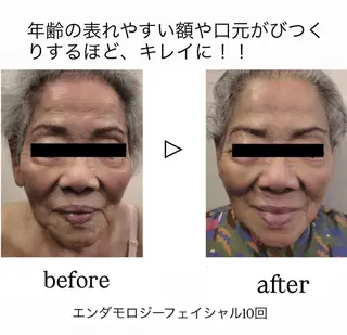 Binosu所属・エンダモロジー BINOSUのエステ・リラクイメージ