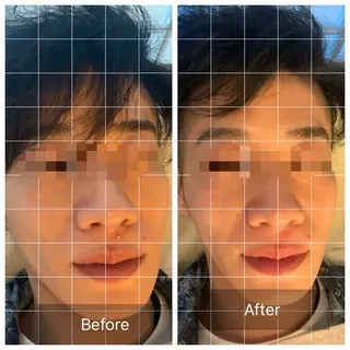 うめきた鍼灸院 SENSEのエステ・リラクイメージ