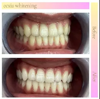 セルフホワイトニングサロンエクシアホワイト倉敷店所属・ecxiawhite 倉敷店のエステ・リラクイメージ