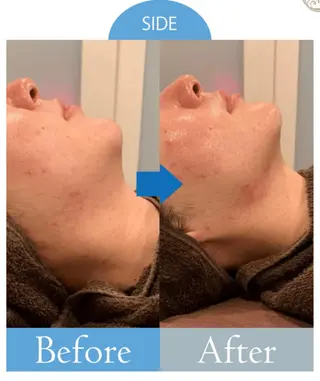 美肌/小顔/眉毛の 専門店 ルミナスのエステ・リラクイメージ