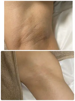 Beauty salon Wish所属・脱毛🌈肌質改善🌈 Wishのエステ・リラクイメージ