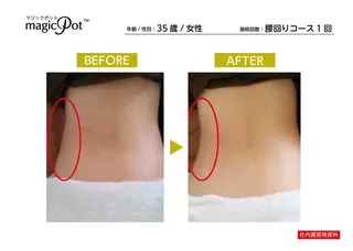 心斎橋痩身ダイエット 韓国.美容鍼.小顔のエステ・リラクイメージ