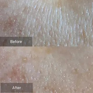 Mandarin Orange所属・毛穴から始める肌メン テマンダリンオレンジのエステ・リラクイメージ