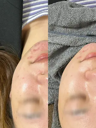 Smoo アユミの眉毛・アイブロウイメージ