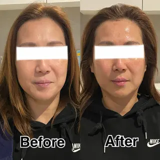 SHELLY 池本知香のエステ・リラクイメージ