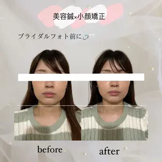 harisalon aleumのエステ・リラクイメージ