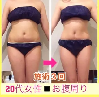 ショート カラー パーマ ヘアアレンジ メンズ キッズ ネイル マツエク・マツパ ‍痩身＆ボディ 結果出し🌟丹野のエステ・リラクイメージ