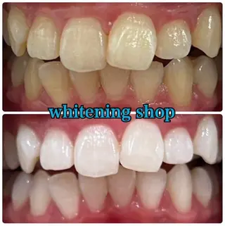 ホワイトニング ショップ吉祥寺店のエステ・リラクイメージ