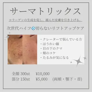 Amaryllis所属・あ あのエステ・リラクイメージ