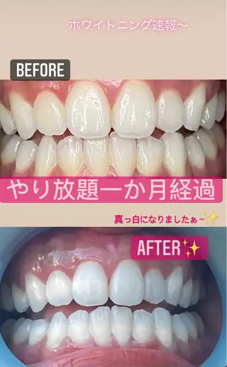 LAVISH nail salonのネイルデザイン