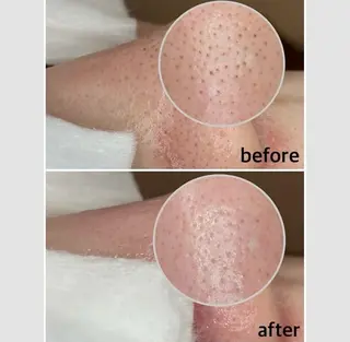 韓国肌管理 【毛穴専科】のエステ・リラクイメージ