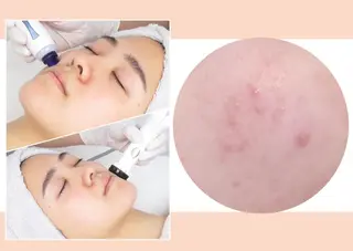 CLEAD赤坂見附店 坂田のエステ・リラクイメージ