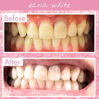 エクシア ホワイト 宇治小倉店のその他イメージ