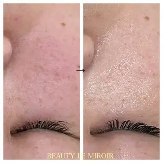 ビューティー ミロワールのエステ・リラクイメージ