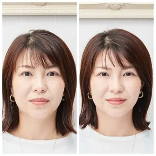 美容鍼　蒼月-aotsuki-所属・美容鍼「蒼月」 -アオツキ-のエステ・リラクイメージ