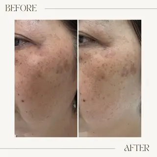 GranDir所属・GranDir 堀井美沙のエステ・リラクイメージ