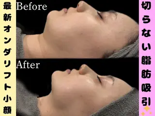 カンナムビューティー麻布十番店所属・bizz bizz 麻布十番🌿のその他イメージ