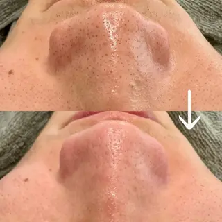 カンナムビューティー麻布十番店所属・bizz bizz 麻布十番🌿のその他イメージ