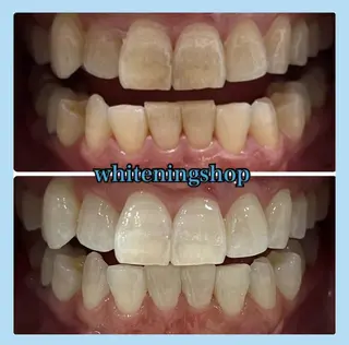 ホワイトニング ショップ千葉店のその他イメージ