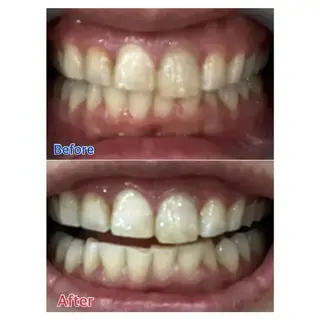 M渋谷店所属・M渋谷 ホワイトニングのエステ・リラクイメージ