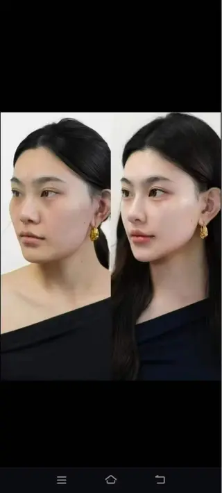 マツエク・マツパ aliaハイフ&水光ジェットサロン所属・aliaハーブ水光店 エステティシャン募集のエステ・リラクイメージ